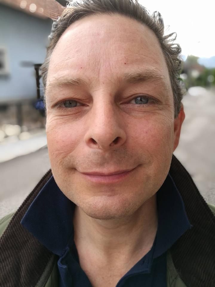 Männer und Botox: Why not?